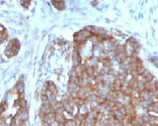 TFF1 / pS2 Antibody (C-Terminus, clone TFF1/1091)