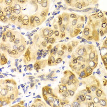 Polyclonal Rabbit anti-Human CPT2 Antibody (IHC, IF, WB)