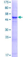Human HDHD3 Protein (Recombinant GST)