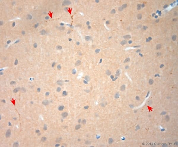 NGF Antibody (aa130-180)