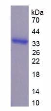 Human AHR Protein (Recombinant His, N-Terminal)