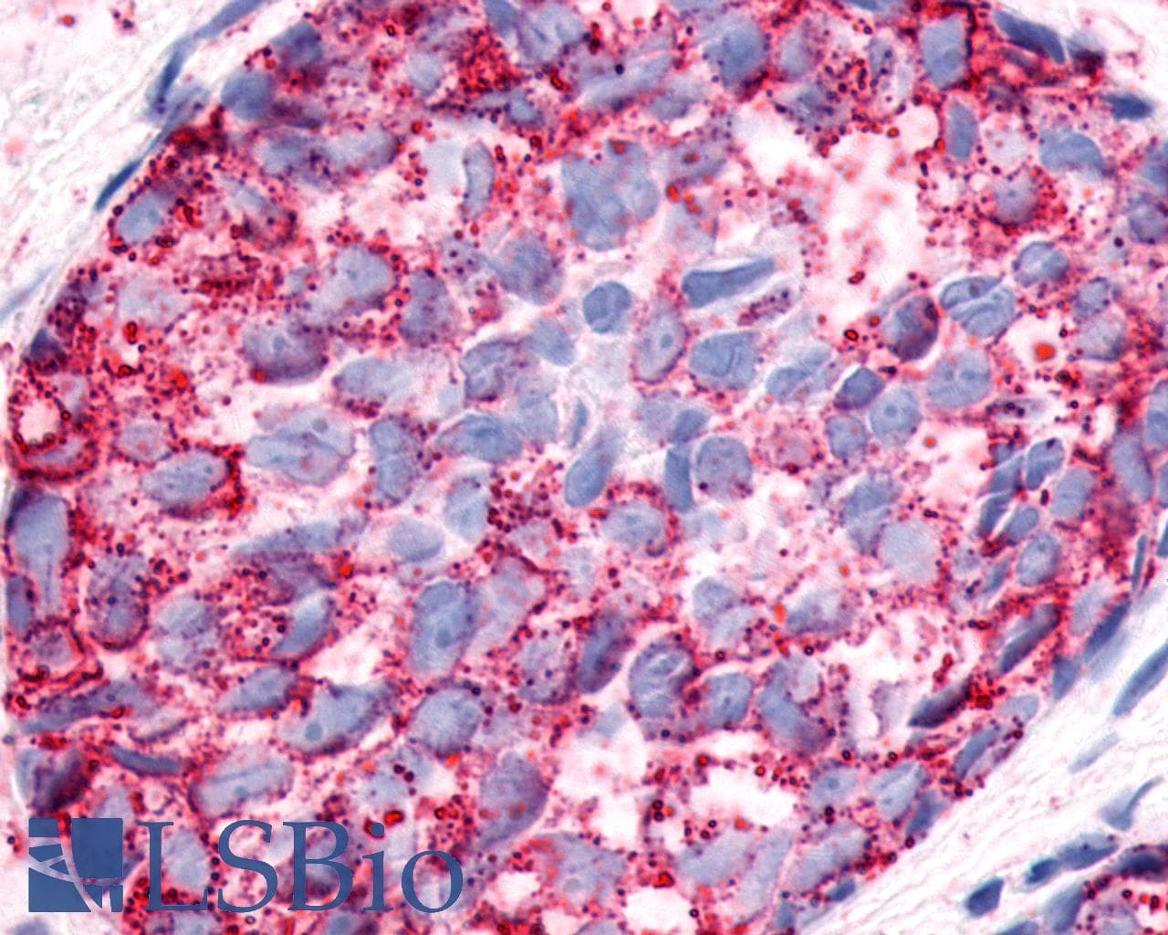 PathPlus™ NPFFR1 / GPR147 Antibody (Extracellular Domain)