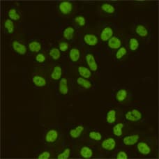 SAFB1 / SAFB Antibody