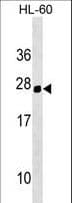 Polyclonal Rabbit anti-Mouse HOXC5 Antibody (aa140-167, WB)