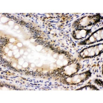 NONO / P54NRB Antibody (aa1-35)