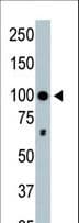 IHC-plus™ HDAC4 Antibody (aa1052-1084)