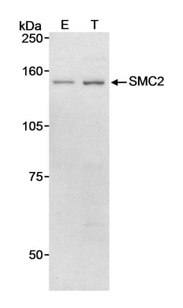 SMC2 Antibody (aa50-100)