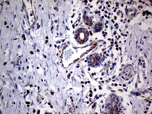 Monoclonal Mouse anti-Human MRPL15 Antibody (clone OTI10B10, aa28-296, IHC, WB)