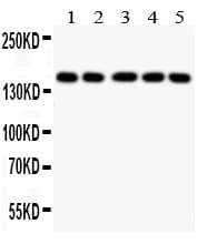 COL2A1 / Collagen II Alpha 1 Antibody (aa1222-1241)