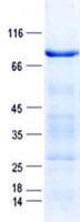 Human PLAT / TPA Protein (Recombinant GST, N-terminus + His, C-terminus)