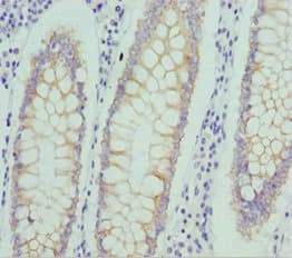 SNARK / NUAK2 Antibody