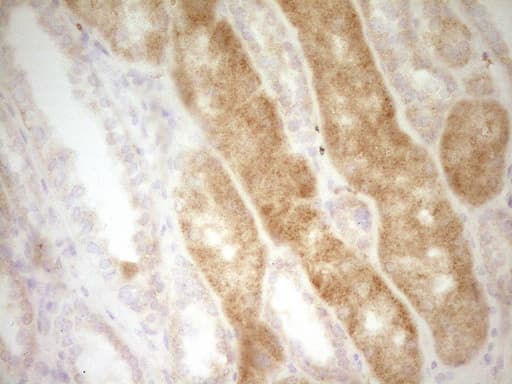 SLAMF7 / CRACC Antibody (clone OTI1F1)