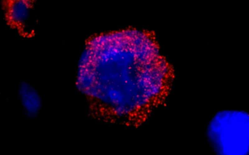 Polyclonal Rabbit anti-Human CML / BCR Antibody (aa50-100, IF)