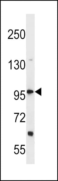 DHX36 Antibody (aa394-420)