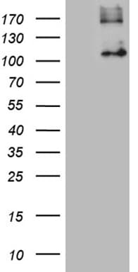 GPNMB / Osteoactivin Antibody (clone OTI2E10)