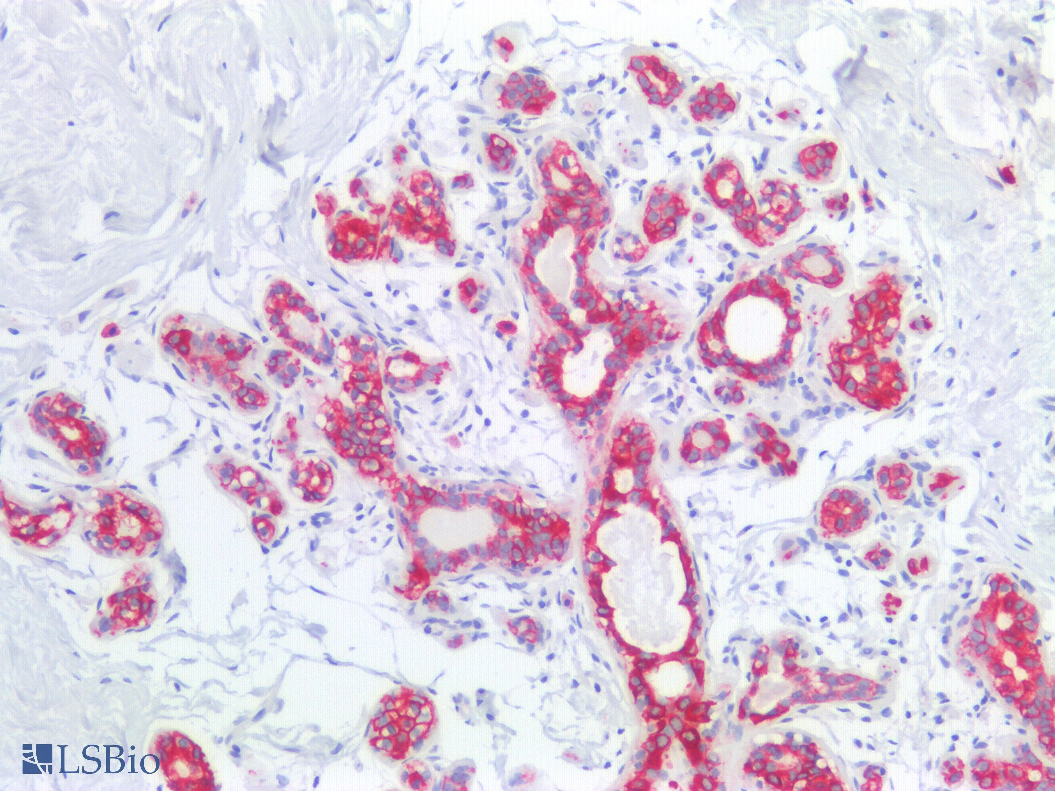 PathPlus™ Polyclonal Rabbit anti-Human KRT8 / CK8 / Cytokeratin 8 Antibody (C-Terminus, IHC, IF, WB)