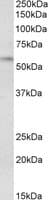 IHC-plus™ Polyclonal Goat anti-Human DGAT1 Antibody (aa217-229, IHC, WB)