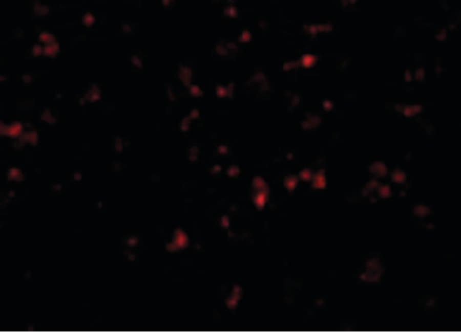 IHC-plus™ Polyclonal Rabbit anti-Human NALP1 / NLRP1 Antibody (IHC, IF, WB)