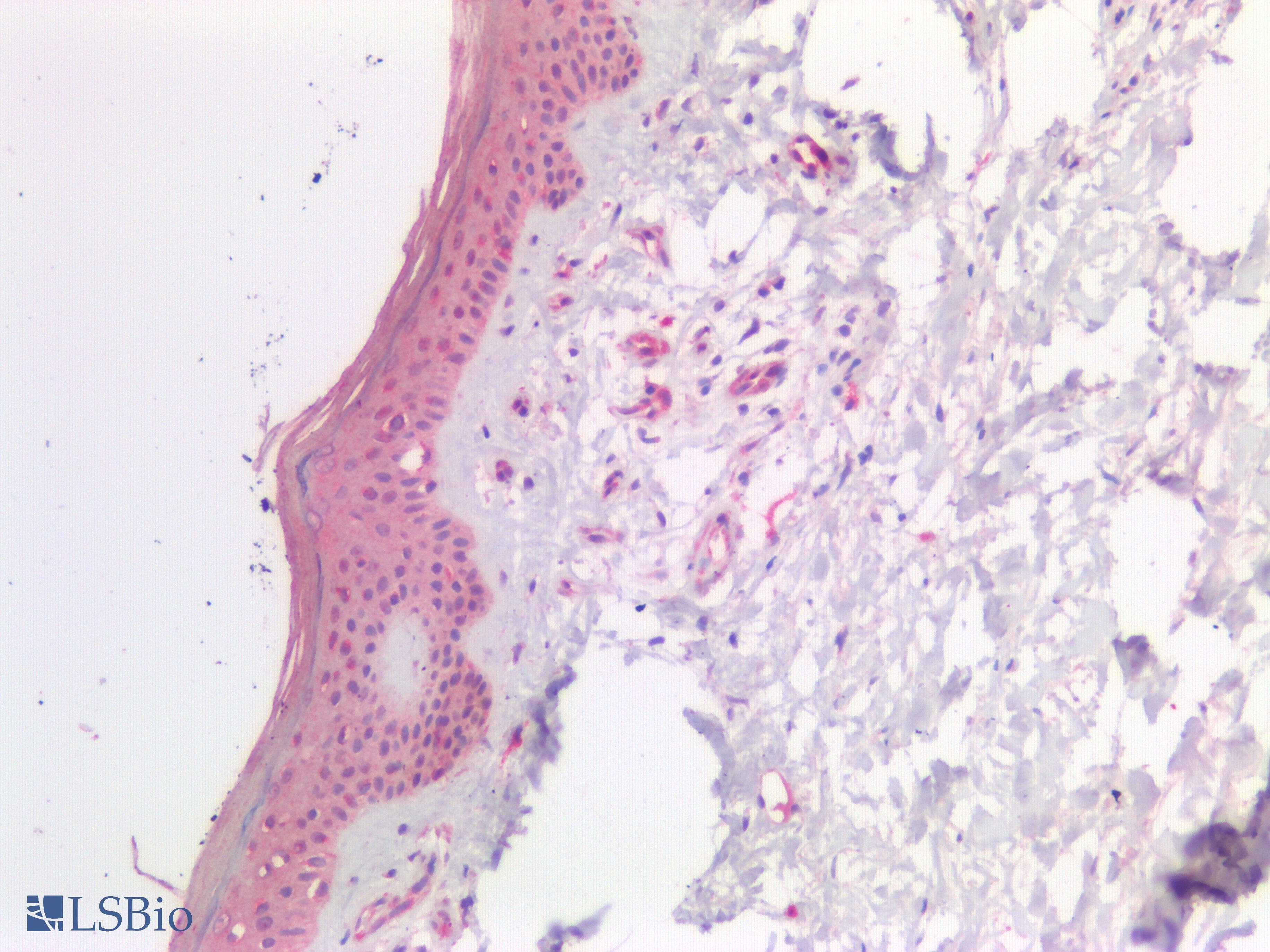 PathPlus™ Polyclonal Rabbit anti-Human SDC1 / Syndecan 1 / CD138 Antibody (IHC)