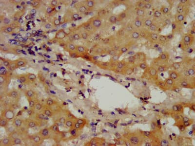 Polyclonal Rabbit anti-Human ADAMTS13 Antibody (IHC)