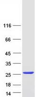 Human APRT Protein (Recombinant Myc-DDK (Flag))