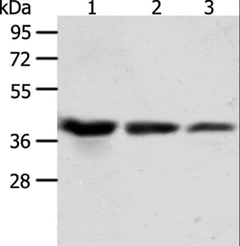 Polyclonal Rabbit anti-Human ANXA1 / Annexin A1 Antibody (WB)