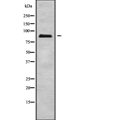 ERCC2 / XPD Antibody
