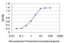 PR / Progesterone Receptor Antibody (clone 1B11)