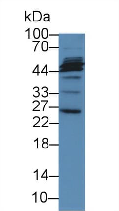 MAGP / MFAP2 Antibody (aa6-162)