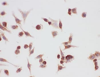 HSP90AA1 / Hsp90 Alpha A1 Antibody (aa2-365)
