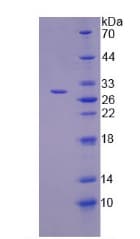 Human TANK2 / TNKS2 Protein (Recombinant His-T7, N-terminus)