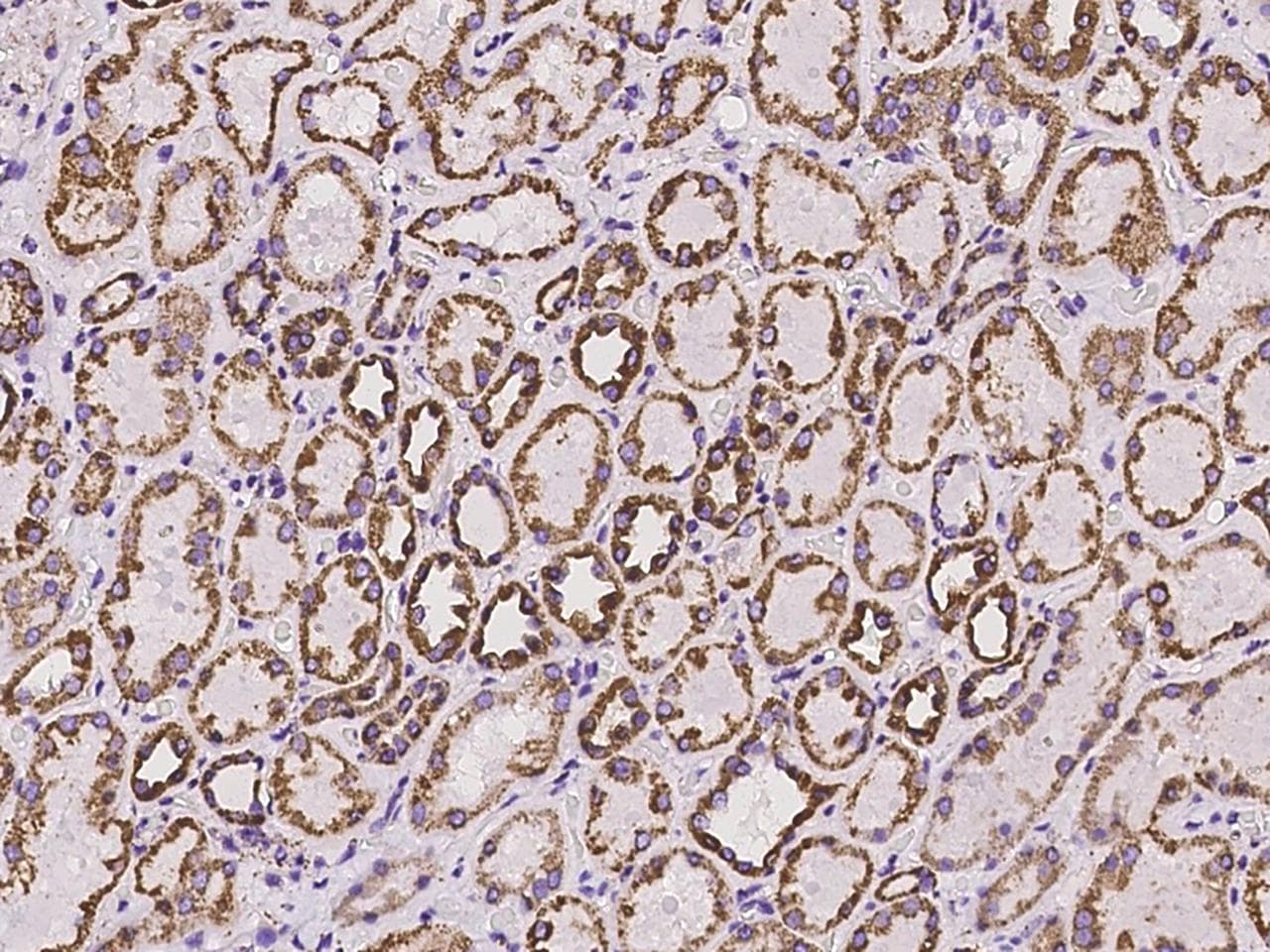 Polyclonal Rabbit anti-Human ADAM15 Antibody (IHC, IF)