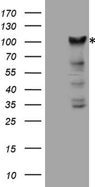Monoclonal Mouse anti-Human KIAA1524 / p90 Autoantigen Antibody (clone OTI1C11, aa635-905, IHC, WB)