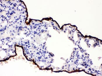 MSLN / Mesothelin Antibody