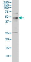 Monoclonal Mouse anti-Human PHF1 Antibody (clone 2D3, WB)