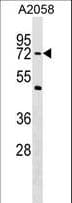 PHF19 Antibody (aa493-520)