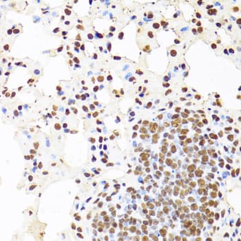CDX2 Antibody
