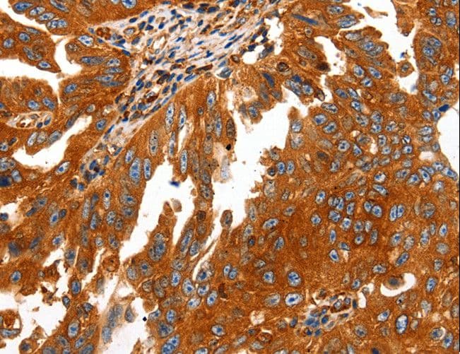Polyclonal Rabbit anti-Human CAP2 Antibody (IHC, WB)