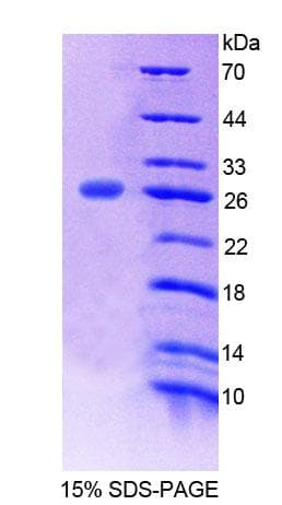 Mouse POMT1 Protein (Recombinant His-T7)