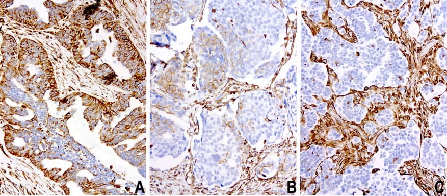 Vimentin Antibody (clone UMAB160, Carrier-free)
