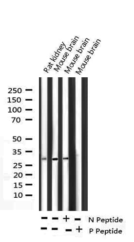 PPP1R1B / DARPP-32 Antibody (phospho-Thr34)