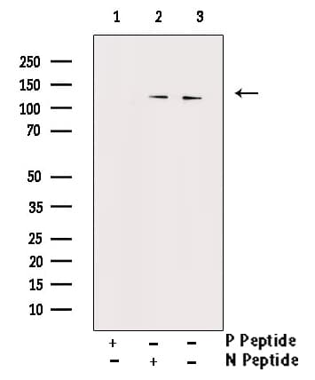 NOS1 / nNOS Antibody (phospho-Ser852)