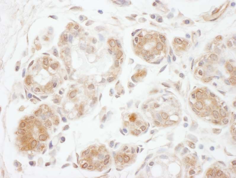 DGKZ Antibody (aa1067-1117)