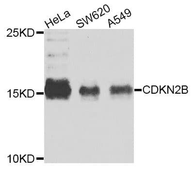 CDKN2B / p15 INK4b Antibody