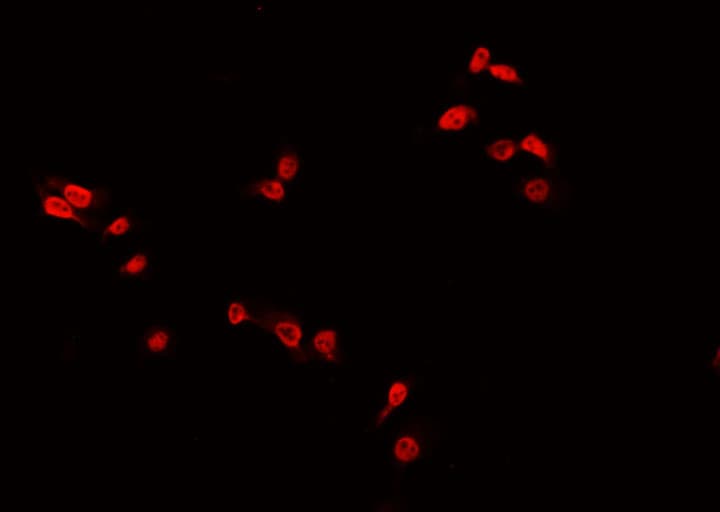 Polyclonal Rabbit anti-Human MED24 / TRAP100 Antibody (IF, WB)