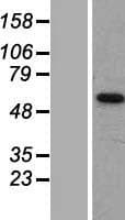 SLC16A6 / MCT6 Protein (Over-Expression Lysate Myc-DDK (Flag))