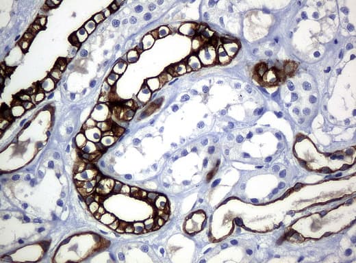 Monoclonal Mouse anti-Human KRT19 / CK19 / Cytokeratin 19 Antibody (clone UMAB3, aa240-390, IHC, IF, WB)