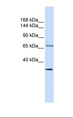 SEMA6D / Semaphorin 6D Antibody (aa182-231, FITC)