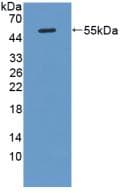 KLK8 / Kallikrein 8 Antibody (aa34-260)