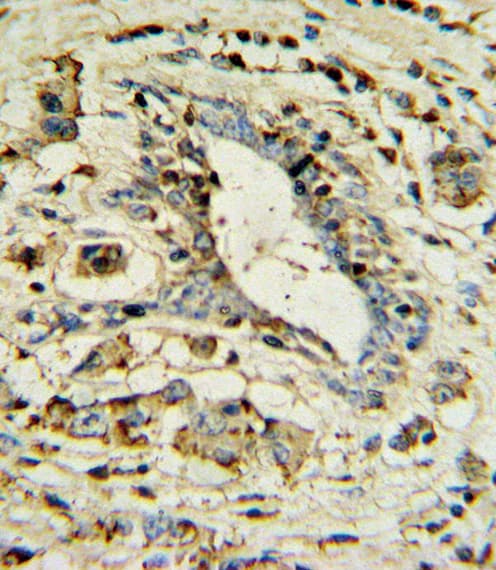APOL1 / Apolipoprotein L Antibody (aa137-171)